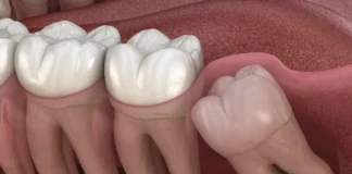 Šok razkritje modrostni zobje skrivajo skrivnost mladosti ki je ne poznate….