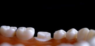 Dragi zobni vsadki bodo kmalu preteklost: na voljo bo obliž zaradi katerega vam bo ponovno lahko zrastel zob!