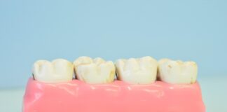 Razkritje zobozdravnika po 50 letih prakse: zob ne uniči sladkor – uniči jih pomanjkanje sline!