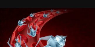 REVOLUCIJA V MEDICINI: Robot velik kot zrno riža razbija ledvične kamne – brez operacije in brez bolečin!