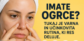 Ogrci? Ne počnite te napake – zaradi nje je lahko vaš obraz videti še slabše! Kako ravnati s kožo?